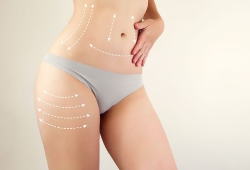 Lipoescultura